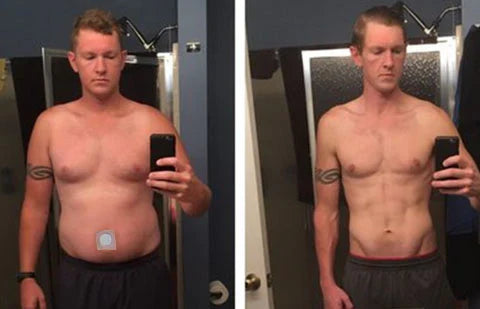 Natravor™ GLP-1 Patches – Fast Results for a Slimmer, Healthier You