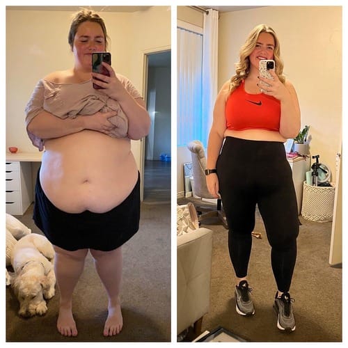 Natravor™ GLP-1 Patches – Fast Results for a Slimmer, Healthier You