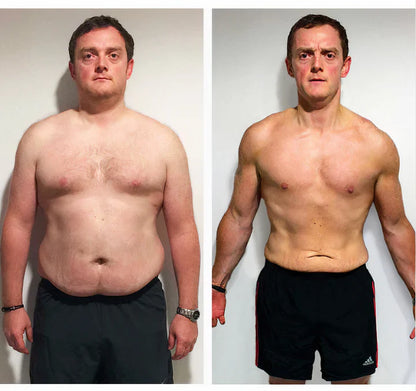 Natravor™ GLP-1 Patches – Fast Results for a Slimmer, Healthier You