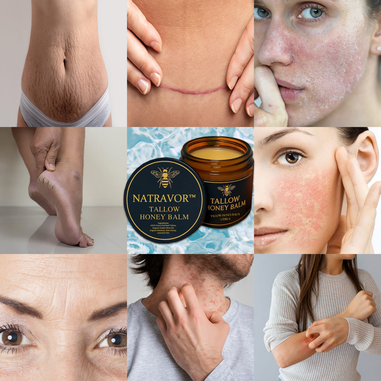 Organic Grass-Fed Beef Tallow Balm with Raw Honey - Handmade All-Natural Moisturizer for Soft, Smooth, Radiant Skin