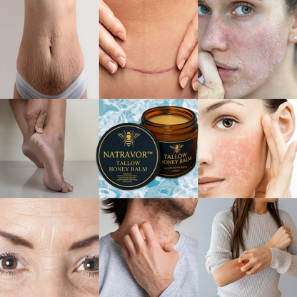 Organic Grass-Fed Beef Tallow Balm with Raw Honey - Handmade All-Natural Moisturizer for Soft, Smooth, Radiant Skin