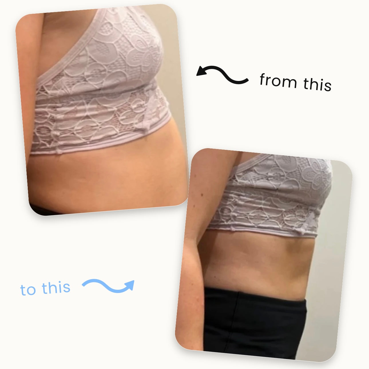 [Official Store]Natravor™ Slimming Patches 🍏｜🔥 Fast Fat Burn & Metabolic Balance｜Backed by Obesity Research Experts